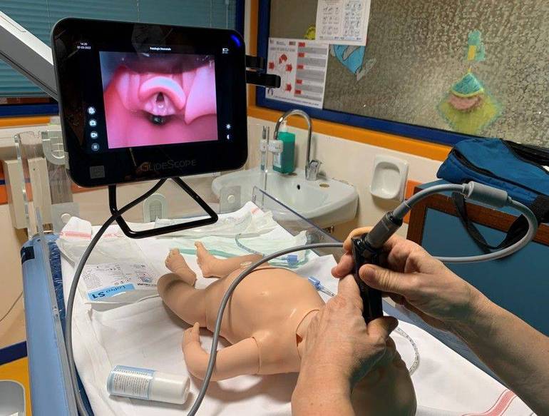 ULSS 2: un videolaringoscopio alla Terapia intensiva neonatale di Treviso